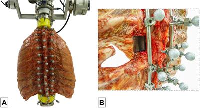 Thoracic Spinal Stability and Motion Behavior Are Affected by the Length of Posterior Instrumentation After Vertebral Body Replacement, but Not by the Surgical Approach Type: An in vitro Study With Entire Rib Cage Specimens